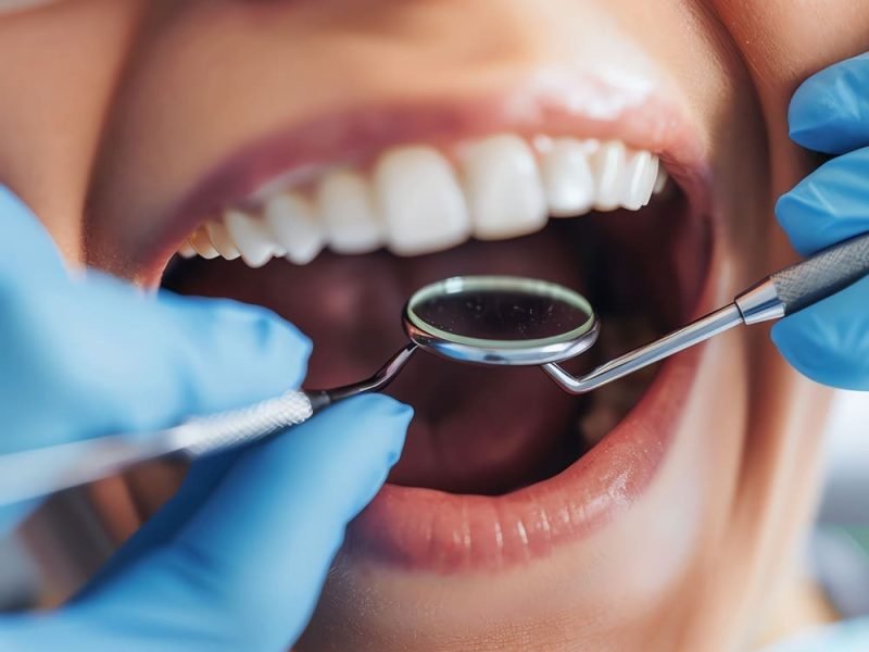 Planos odontológicos